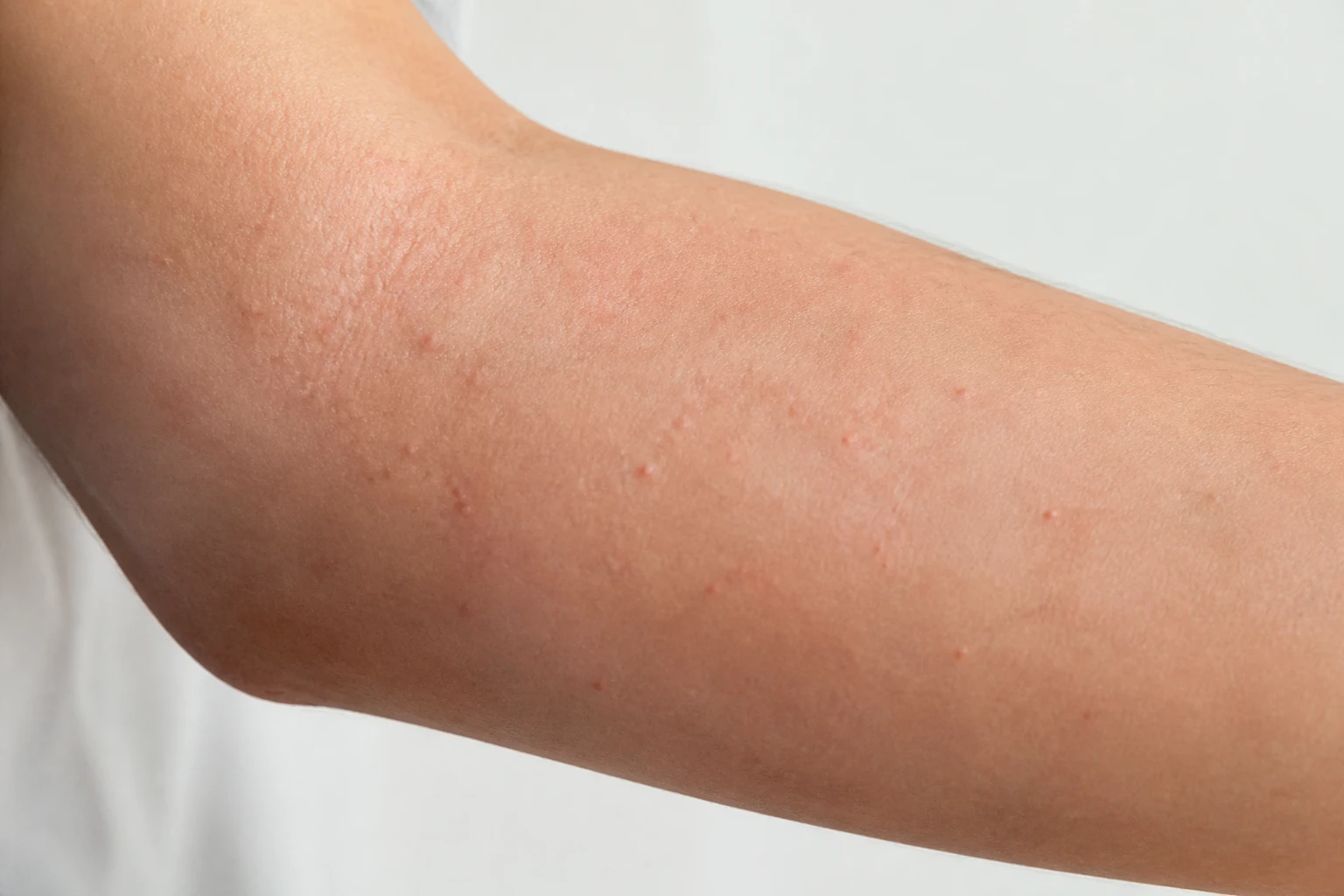 Allergie à la lessive : boutons, causes et solutions